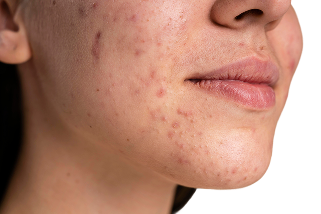 Close-up of skin with pigmentation concerns